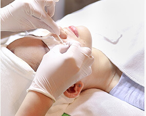 Loại bỏ mụn để laser tập trung năng lượng